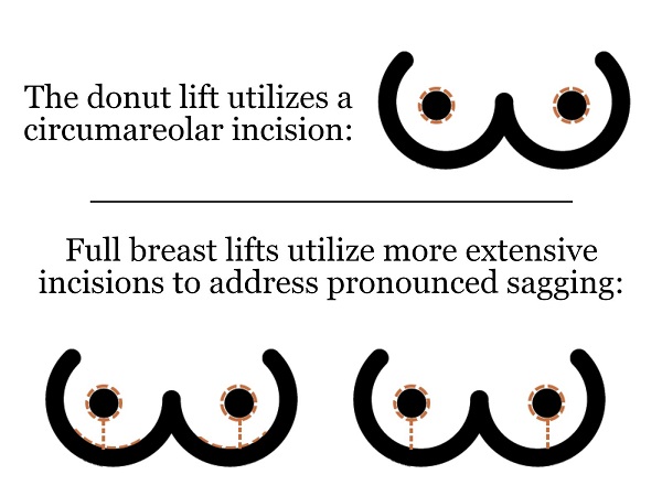 Comprehensive Guide to Different Types of Breasts & more